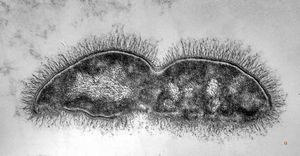 M,35y. | bacilliform microbes in haemoperfusion capsule